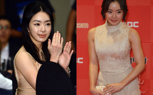 Đại mỹ nhân showbiz thất thế, bị tất cả bạn bè từ mặt hậu “dao kéo” hỏng- Ảnh 2.