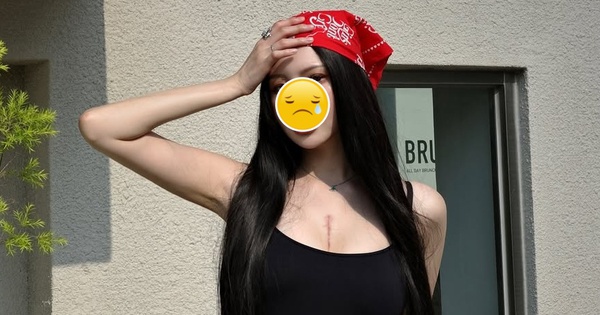 Nữ thần sắc đẹp 29 tuổi qua đời vào sáng nay vì mắc bệnh hiếm gặp snapinstato499991740185063630500131978911222827841689769n 17690746420311842713612 0 0 458 874 crop 1769091944451269569081jpg