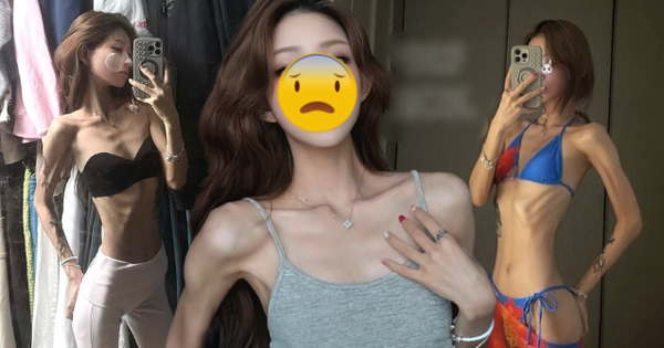 Phát sợ với cơ thể gầy trơ xương, héo mòn của con gái "nữ diễn viên quốc dân" thiet ke chua co ten 15 1769845451313208755140 0 0 335 640 crop 17698454594801873714109png