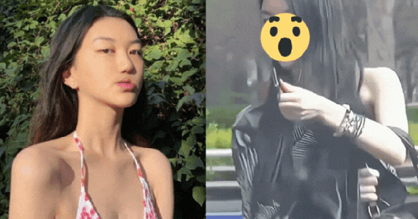 Con gái Vương Phi diện mạo khó tin sau 4 lần phẫu thuật hở hàm ếch, đã có bạn trai ở tuổi 20 thiet ke chua co ten 18 1768031341972935008653 0 0 335 640 crop 17680313513381926850074gifpng