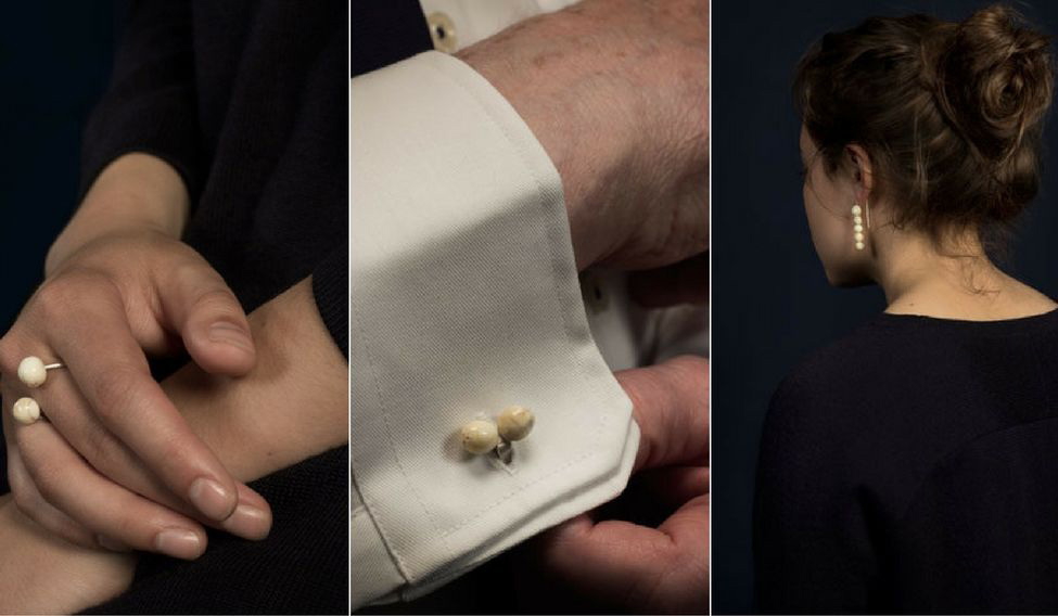 Cô gái chuyên thu mua răng người- Ảnh 2. Cô gái chuyên thu mua răng người- Ảnh 2.