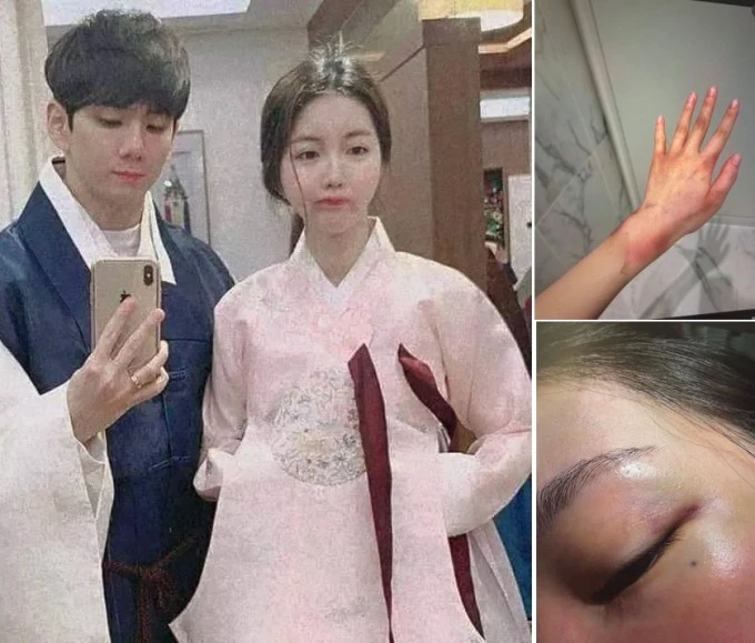 Anh trai Jisoo bị vợ cũ tố đánh đập, bạo hành tình dục dã man