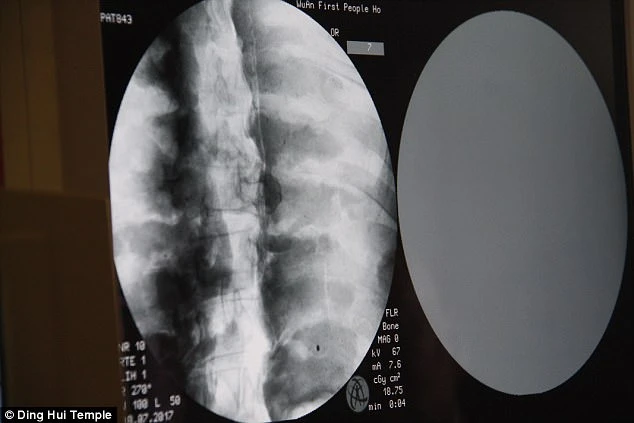 Bức tượng nhà sư mạ vàng 1.000 năm tuổi bất ngờ "hiện nguyên hình" sau khi quét CT: Còn nguyên bộ não và xương