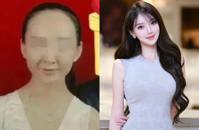 Hoa khôi sinh con cho Huỳnh Hiểu Minh “dao kéo” 100% cơ thể, xem diện mạo trước chỉnh sửa mà sốc nặng Hoa khôi sinh con cho Huỳnh Hiểu Minh “dao kéo” 100% cơ thể, xem diện mạo trước chỉnh sửa mà sốc nặng