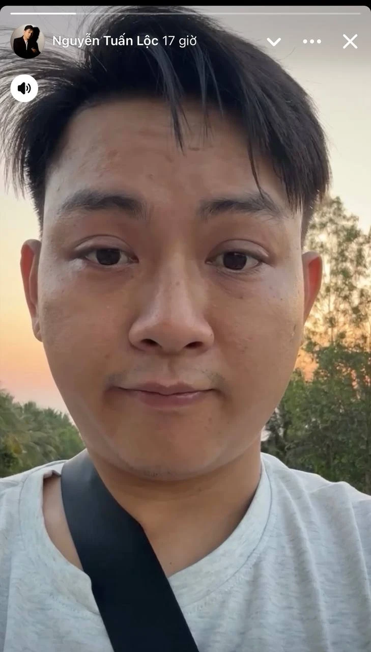 Hoài Lâm: Từng được so sánh ngang ngửa Sơn Tùng, nay diện mạo xuề xoà khó tin