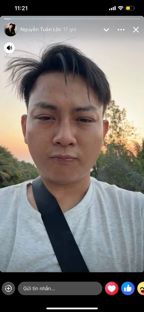 Hoài Lâm: Từng được so sánh ngang ngửa Sơn Tùng, nay diện mạo xuề xoà khó tin