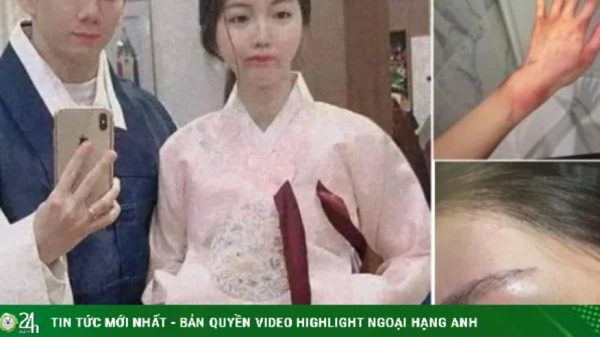 Anh trai Jisoo bị vợ cũ tố đánh đập, bạo hành tình dục dã man kenhtingame com thumb anh trai jisoo bi vo cu to danh dap bao hanh tinh duc da man 9e4c1776586327879 940w