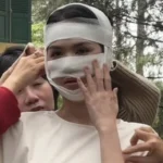 Hình ảnh Ngọc Trinh băng bó kín cả mặt kenhtingame com thumb hinh anh ngoc trinh bang bo kin ca mat dd341775801872939 940w