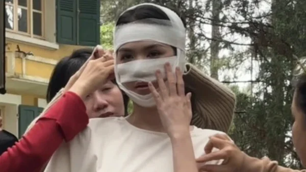 Hình ảnh Ngọc Trinh băng bó kín cả mặt kenhtingame com thumb hinh anh ngoc trinh bang bo kin ca mat dd341775801872939 940w