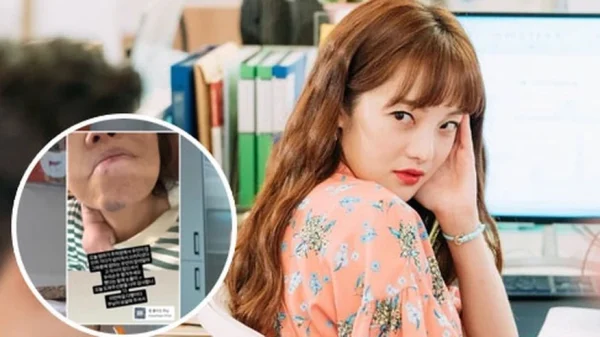 Mỹ nhân Thư Ký Kim bật khóc nấc vì mẹ ruột gặp tai nạn đến chấn động não trong lúc trông cháu kenhtingame com thumb m nhan thu ky kim bat khoc nac vi me ruot gap tai nan den chan dong nao trong luc trong chau 17d01775631197903 940w