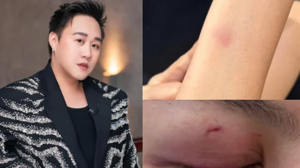 Mới nhất drama hành hung nữ bác sĩ: Trung Quân Idol thông báo ngưng hoạt động rồi xoá post sau 10 phút kenhtingame com thumb moi nhat drama hanh hung nu bac si trung quan idol thong bao ngung hoat dong roi xoa post sau 10 phut 32691776780234047 940w
