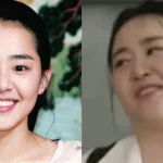 Moon Geun Young bị hoại tử và phát tướng mất kiểm soát do bệnh quái ác, bỏ lỡ giai đoạn vàng để điều trị kenhtingame com thumb moon geun young bi hoai tu va phat tuong mat kiem soat do benh quai ac bo lo giai doan vang de dieu tri e6821776323178932 940w