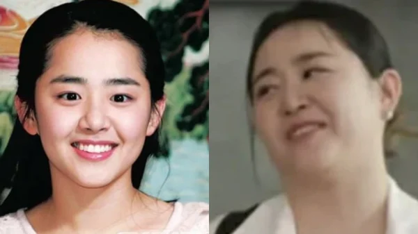 Moon Geun Young bị hoại tử và phát tướng mất kiểm soát do bệnh quái ác, bỏ lỡ giai đoạn vàng để điều trị kenhtingame com thumb moon geun young bi hoai tu va phat tuong mat kiem soat do benh quai ac bo lo giai doan vang de dieu tri e6821776323178932 940w
