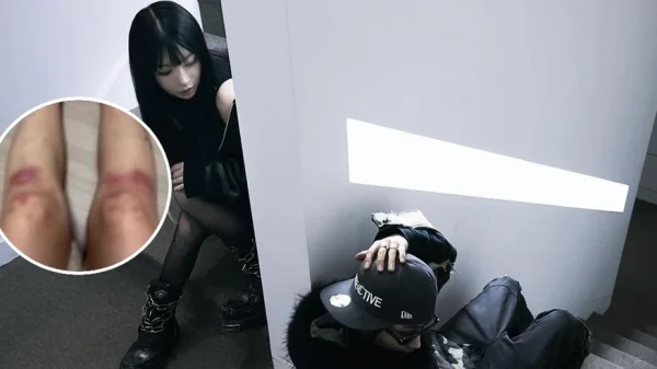 Nữ ca sĩ yêu lại bạn trai cũ từng đánh cô bầm dập toàn thân: “Tôi không kiện anh ấy nữa” kenhtingame com thumb nu ca si yeu lai ban trai cu tung danh co bam dap toan than toi khong kien anh ay nua f4e91775519210643 940w