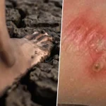 Thái Lan cảnh báo khẩn về dịch "sốt đất": 732 ca nhiễm, 23 trường hợp tử vong kenhtingame com thumb thai lan canh bao khan ve dich quot sot dat quot 732 ca nhiem 23 truong hop tu vong b0681776524938550 940w