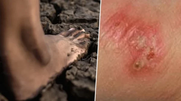 Thái Lan cảnh báo khẩn về dịch "sốt đất": 732 ca nhiễm, 23 trường hợp tử vong kenhtingame com thumb thai lan canh bao khan ve dich quot sot dat quot 732 ca nhiem 23 truong hop tu vong b0681776524938550 940w