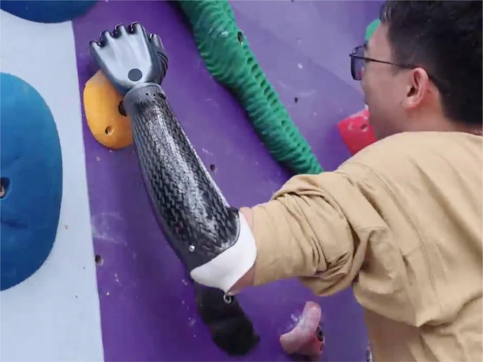 Trung Quốc lại một lần nữa khiến cả thế giới bất ngờ với cánh tay giả có thể "đọc" suy nghĩ và di chuyển linh hoạt ngay cả khi không kết nối với cơ thể người! Trung Quốc lại một lần nữa khiến cả thế giới bất ngờ với cánh tay giả có thể "đọc" suy nghĩ và di chuyển linh hoạt ngay cả khi không kết nối với cơ thể người!