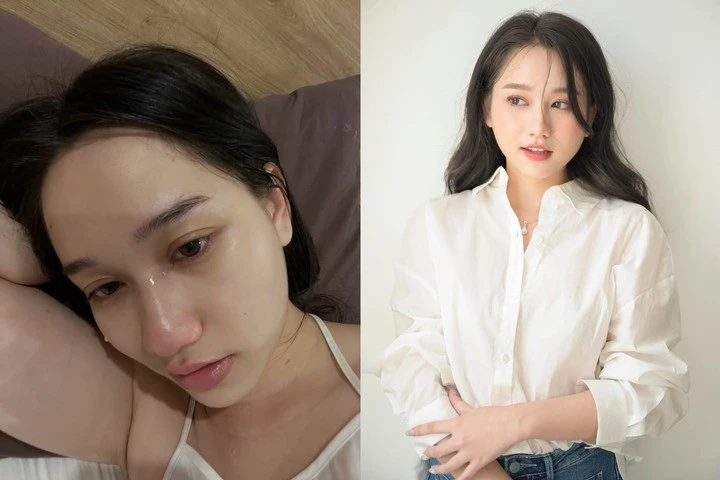 3 nàng thơ Mắt biếc sau 7 năm: Người chật vật vì bệnh tật, người là phú bà 3 nàng thơ Mắt biếc sau 7 năm: Người chật vật vì bệnh tật, người là phú bà