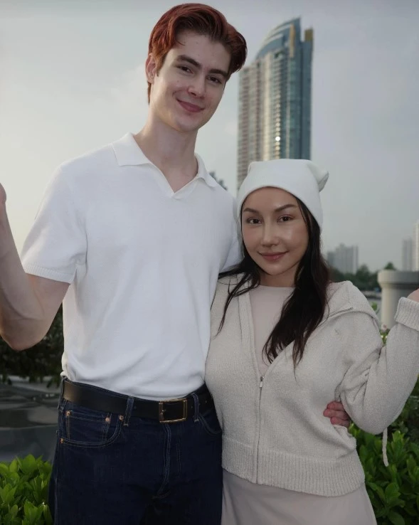 Gương mặt sau 21 ngày phẫu thuật thẩm mỹ của cô vợ cao 1m55 áp lực vì chồng Tây quá đẹp trai, cao gần 2m Gương mặt sau 21 ngày phẫu thuật thẩm mỹ của cô vợ cao 1m55 áp lực vì chồng Tây quá đẹp trai, cao gần 2m