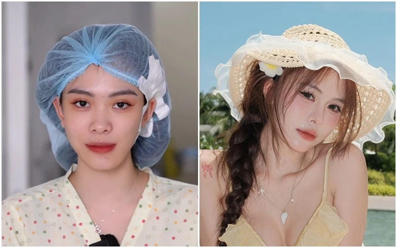 Hà Môi “đắp tiền lên mặt” để sửa những gì? Còn chiếc mũi “đang hếch dần và méo” giờ ra sao?
