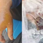 Bị rắn hổ mang chúa dài 2 mét cắn, người đàn ông chém đứt xác rắn rồi đến bệnh viện kenhtingame com thumb bi ran ho mang chua dai 2 met can nguoi dan ong chem dut xac ran nbsp roi den benh vien bf851778761793721 940w