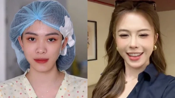 Hà Môi “đắp tiền lên mặt” để sửa những gì? Còn chiếc mũi “đang hếch dần và méo” giờ ra sao? kenhtingame com thumb ha moi dap tien len mat de sua nhung gi con chiec mui dang hech dan va meo gio ra sao 53191777628956057 940w