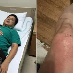 NSƯT Chí Trung mắc bệnh lạ kenhtingame com thumb nsut chi trung mac benh la 31261778708730323 940w
