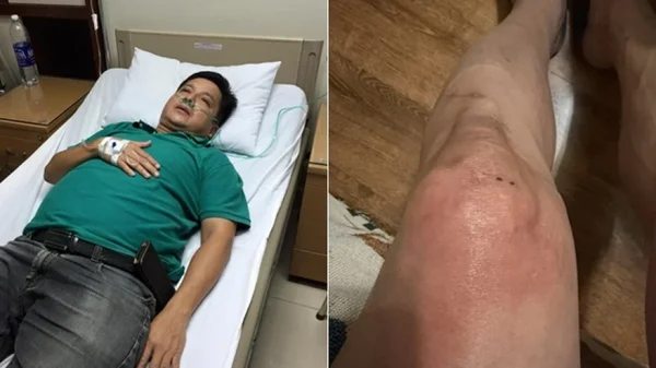 NSƯT Chí Trung mắc bệnh lạ kenhtingame com thumb nsut chi trung mac benh la 31261778708730323 940w