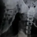 Hành động thân mật quá mức, đại gia donate khiến nữ streamer xinh đẹp bị gãy xương sống kenhtingame com thumb hanh dong than mat qua muc dai gia donate khien nu streamer xinh dep bi gay xuong song 411e1782211093060 940w