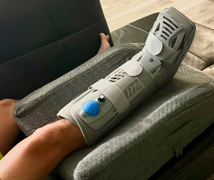Ca sĩ Mạnh Quỳnh bị vỡ xương mắt cá chân