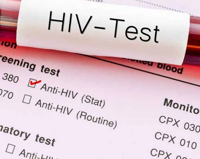 Nữ nghiên cứu sinh tiến sĩ 27 tuổi ngỡ ngàng nhận kết quả dương tính HIV sau kỳ khám sức khỏe Nữ nghiên cứu sinh tiến sĩ 27 tuổi ngỡ ngàng nhận kết quả dương tính HIV sau kỳ khám sức khỏe