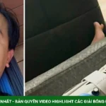 Ca sĩ Mạnh Quỳnh bị vỡ xương mắt cá chân kenhtingame com thumb ca si manh quynh bi vo xuong mat ca chan 96cf1786626088946 940w