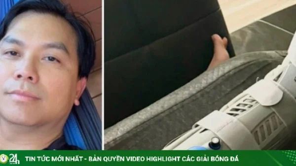 Ca sĩ Mạnh Quỳnh bị vỡ xương mắt cá chân kenhtingame com thumb ca si manh quynh bi vo xuong mat ca chan 96cf1786626088946 940w