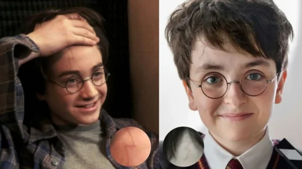 Harry Potter HBO Hé Lộ Thiết Kế Vết Sẹo Mới Của Harry kenhtingame com thumb harry potter hbo he lo thiet ke vet seo moi cua harry 04931787204379612 940w