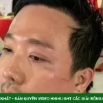 Trấn Thành chỉ ngủ 12 phút/ngày kenhtingame com thumb tran thanh chi ngu 12 phut ngay 009a1787214462022 940w