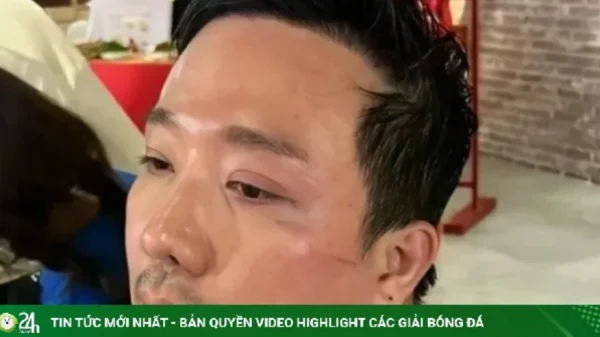 Trấn Thành chỉ ngủ 12 phút/ngày kenhtingame com thumb tran thanh chi ngu 12 phut ngay 009a1787214462022 940w
