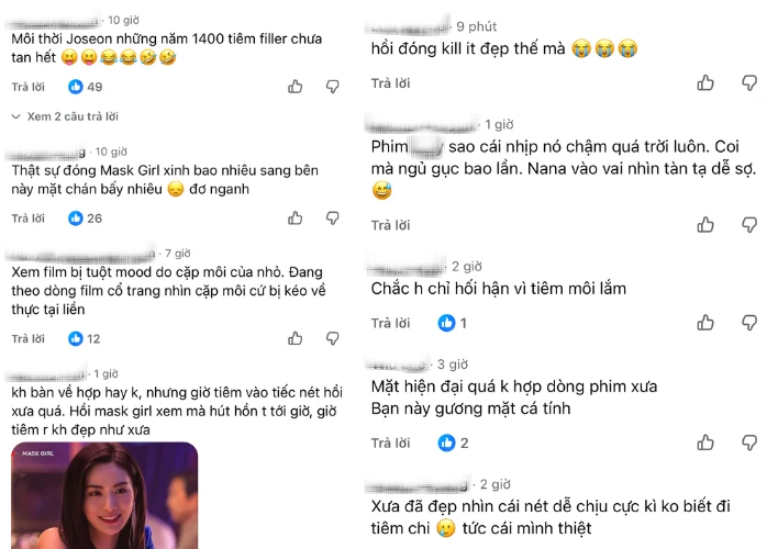 Mỹ nhân đẹp nhất thế giới vướng tranh cãi vì tiêm filler lố Mỹ nhân đẹp nhất thế giới vướng tranh cãi vì tiêm filler lố