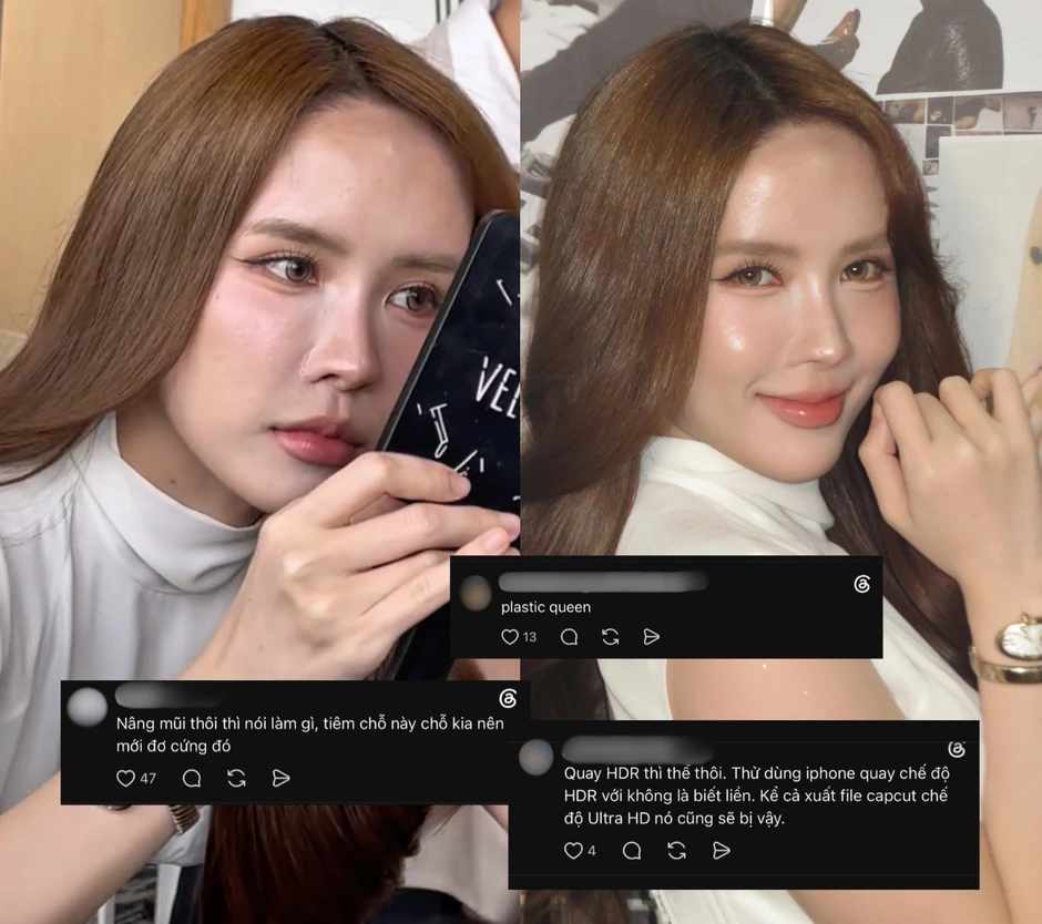 Gương mặt của Thiều Bảo Trâm đang khiến nhiều người lo lắng