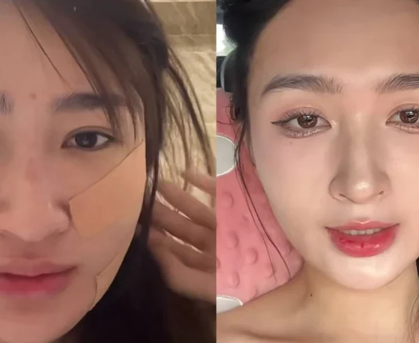 Mỹ nhân SN 2001 đóng phim giờ vàng VTV công khai dung mạo sau khi hút mỡ mặt kenhtingame com thumb m nhan sn 2001 dong phim gio vang vtv cong khai dung mao sau khi hut mo mat 63661793076715167 940w