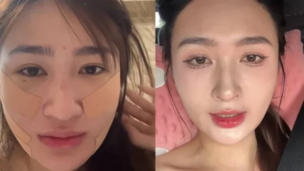 Mỹ nhân SN 2001 đóng phim giờ vàng VTV công khai dung mạo sau khi PTTM kenhtingame com thumb m nhan sn 2001 dong phim gio vang vtv cong khai dung mao sau khi pttm c3ab1793082032930 940w
